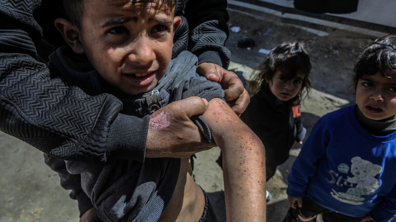 Gazze'de Korkunç Tehlike! Salgın Hastalıklar Kapıda: Dünya Nereye Bakıyor?