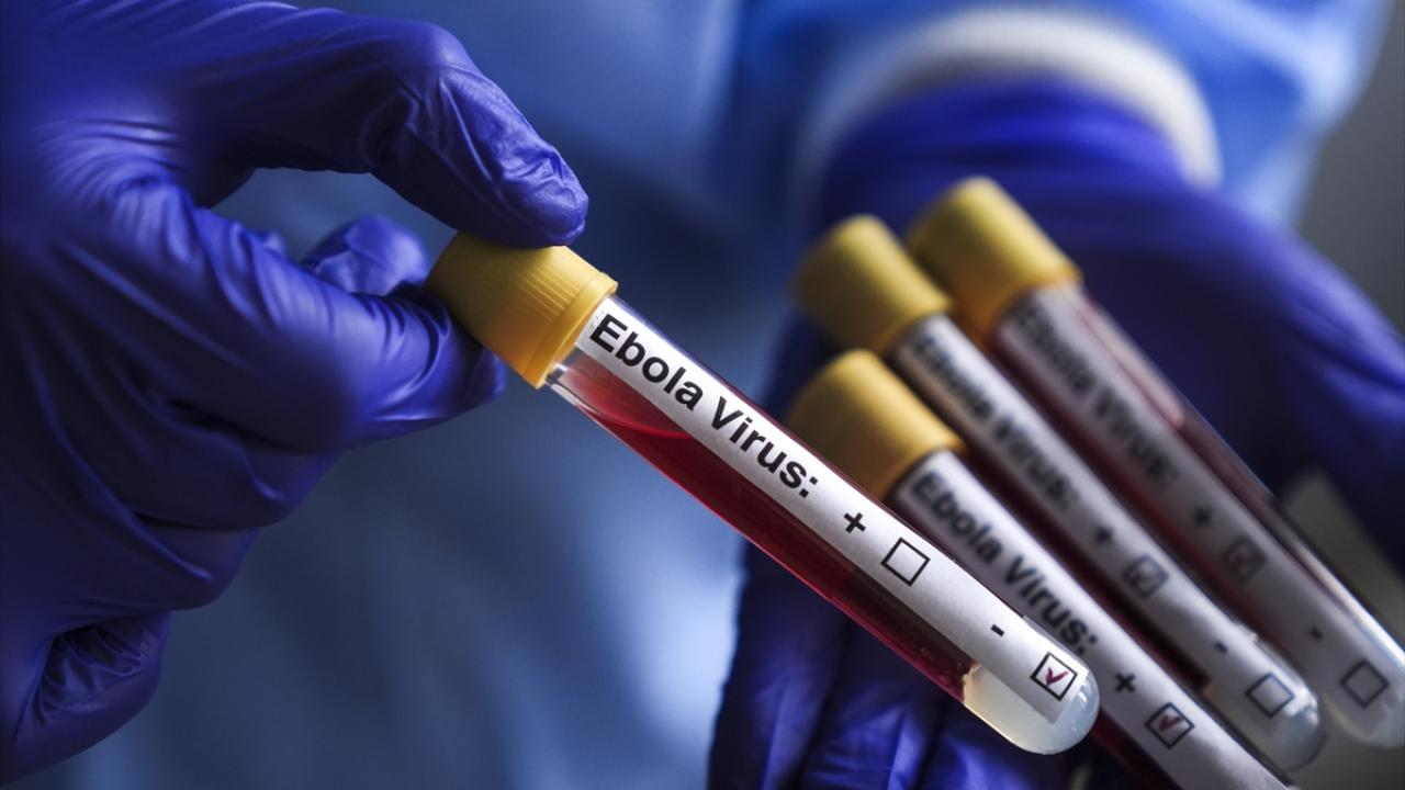 Kongo Demokratik Cumhuriyeti'nde Ebola Salgını: Can Kaybı 1405'e Çıktı